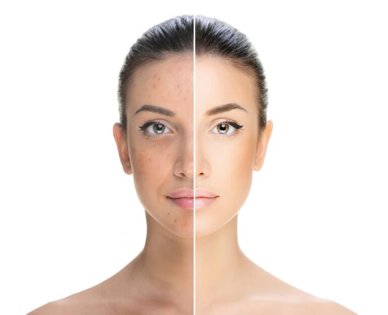 23-1-768x624 اکتیوشناسی: رتینول